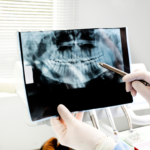 A dentist in white gloves pointing to a digital panoramic dental X-ray, bone graph for dental implants